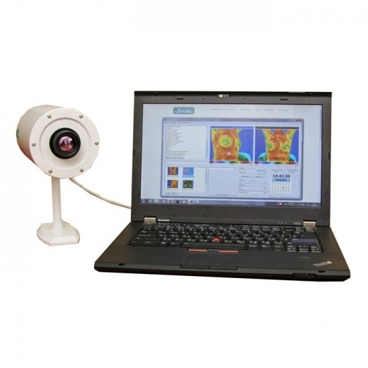 Медицинский тепловизор FLIR PergaMed Купить Медицинский тепловизор FLIR PergaMed в