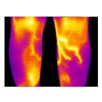 Медицинский тепловизор FLIR PergaMed